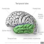 Temporal lobe | Radiology Reference Article | Radiopaedia.org Temporal lobe | Radiology Reference Article | Radiopaedia.org